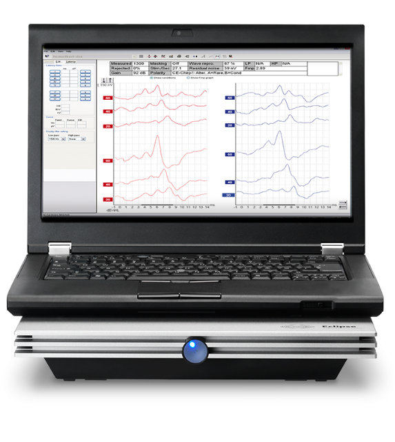 ABR (Auditory Brainstem Response) Test