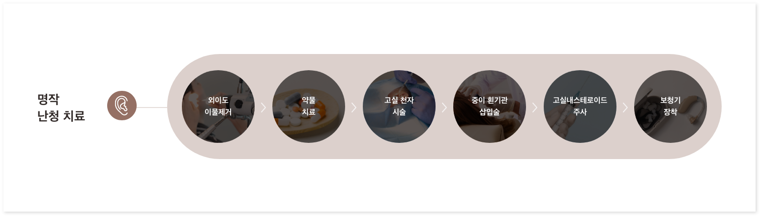 명작 이비인후과 난청 치료 흐름