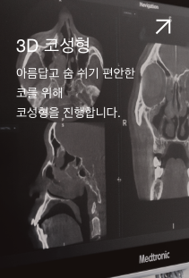 3D 코성형. 아름답고 숨 쉬기 편안한 코를 위해 코성형을 진행합니다.