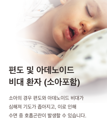 편도 및 아데노이드 비대 환자(소아포함) - 소아의 경우 편도와 아데노이드 비대가 심해져 기도가 좁아지고, 이로 인해 수면 중 호흡곤란이 발생할 수 있습니다.